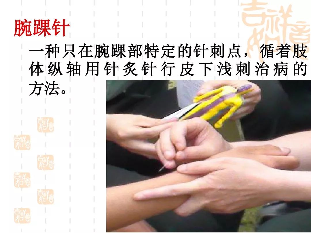 腕踝针疗法的应用