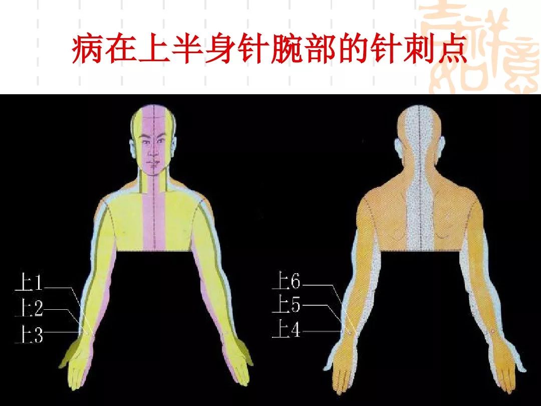 腕踝针疗法的应用