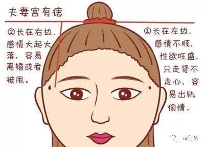 女人右边夫妻宫有痣图片