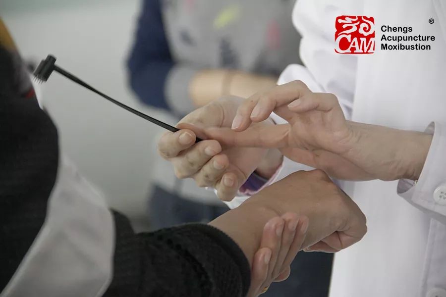 梅花针调节视力_治疗