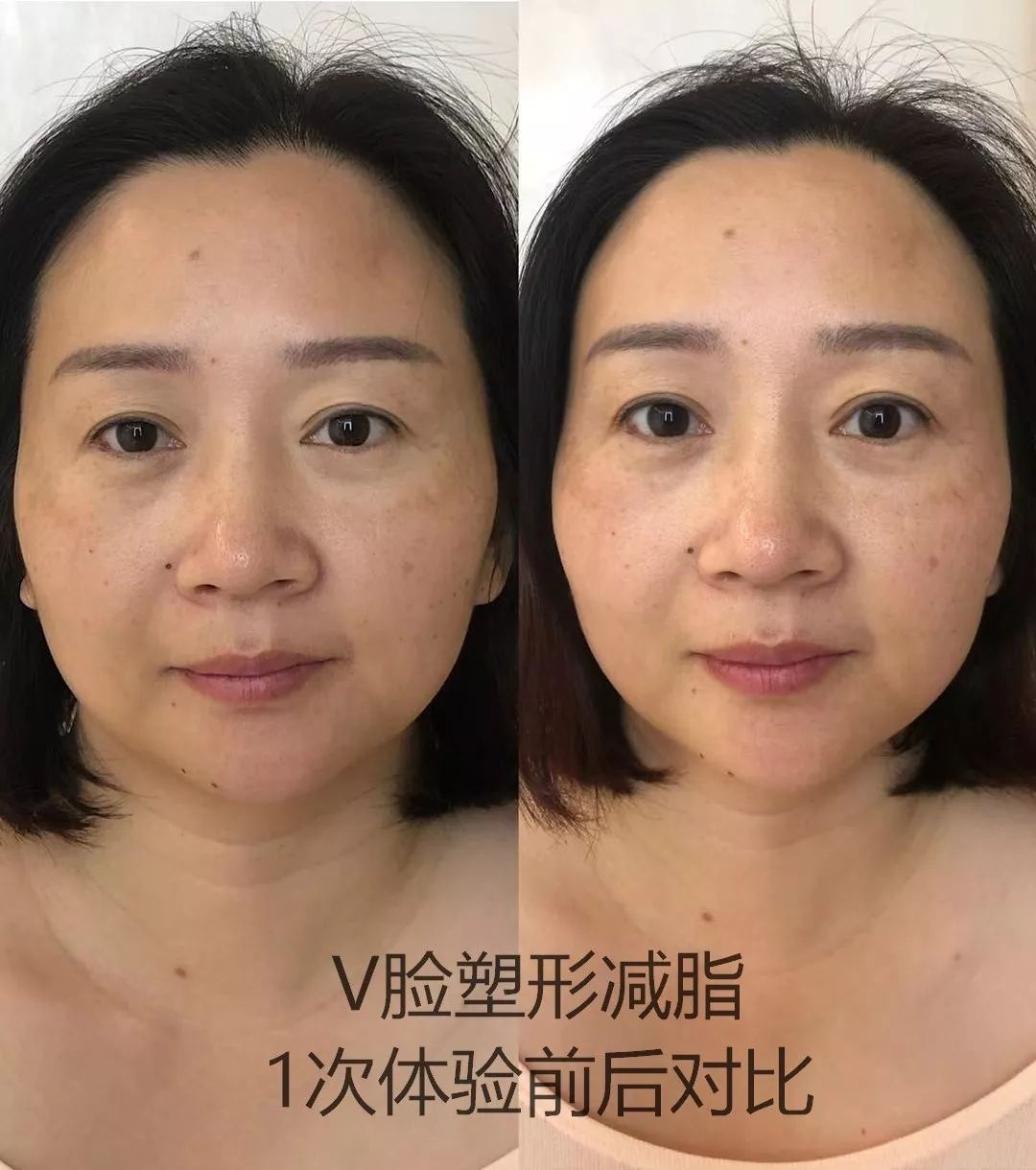 因为不想素颜上镜,所以用了随行小姐姐的对比照做到一半的时候我都