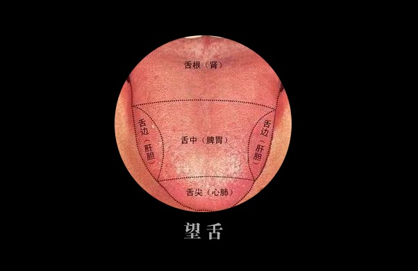 舌诊大全:中医教你望“舌头”知胃肠病,一学就会_舌苔