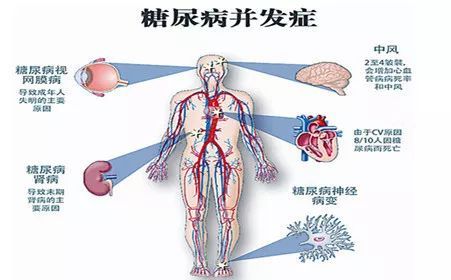 降糖药胰岛素只可抑制血糖值,无法降低并发症的发病几率;糖尿病患者不