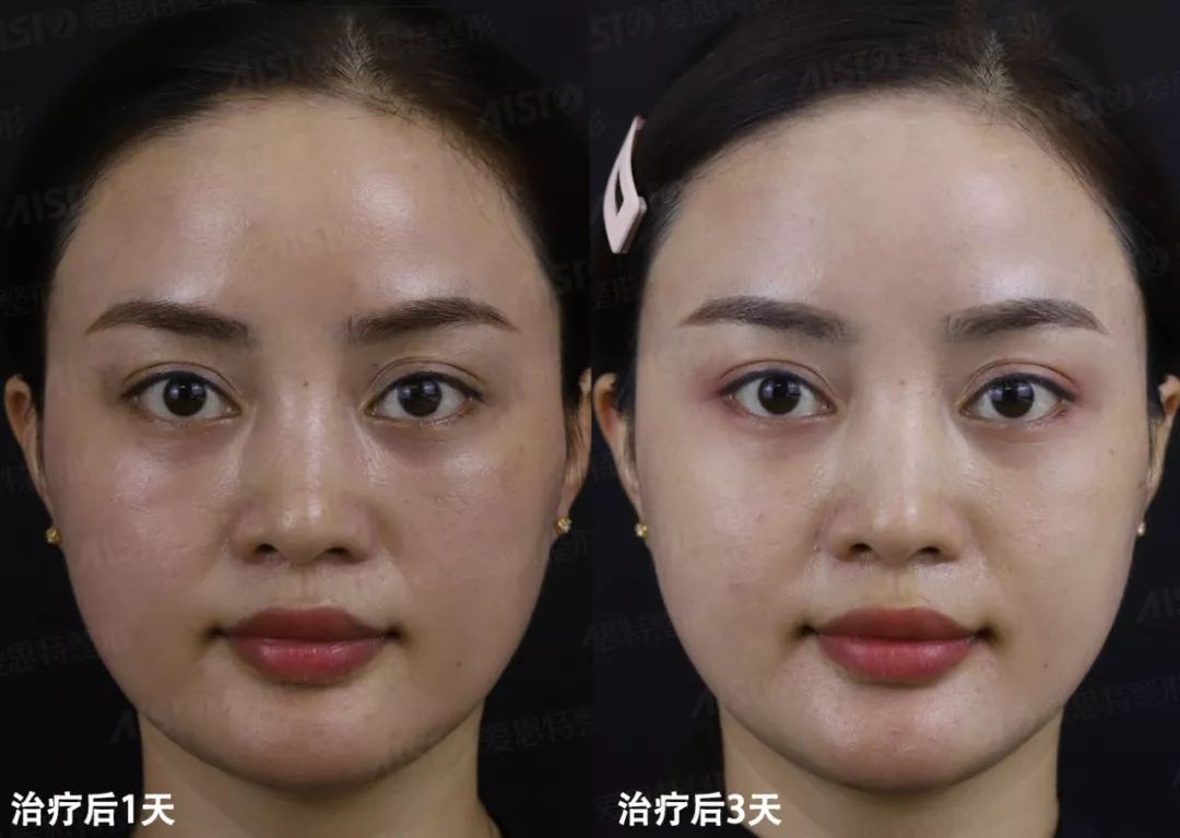 正经科普818胶原蛋白那些事儿