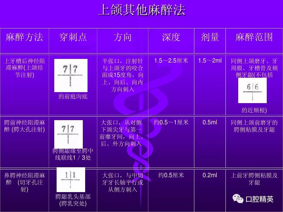 口腔局部麻醉