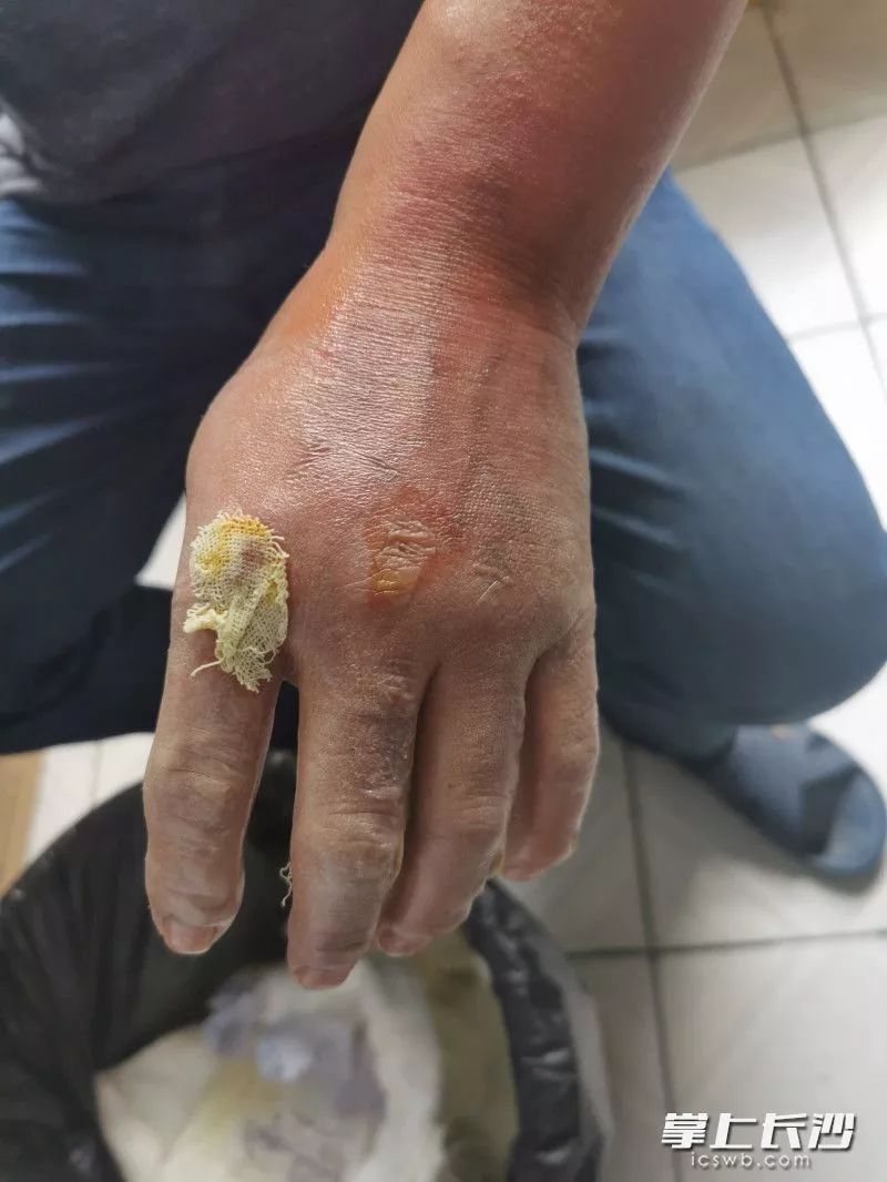 小区厨房突起火大叔两度冲火海麓谷英雄就是他