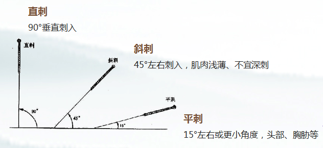 学针灸必备:针刺技术与安全原则,自学针灸教程_发展