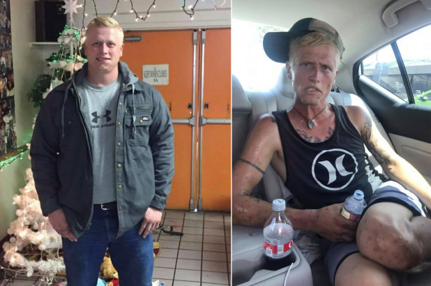 美国母亲晒出儿子吸毒前后对比照仅仅7个月判若两人