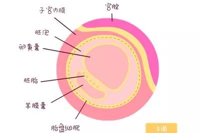 卵黄囊是宫内妊娠的重要标志