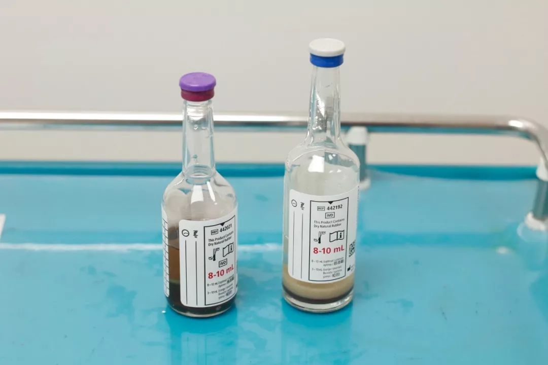 抽取血培养标本,后来检验科打电话说标本被污染,需要重新采集进行检测