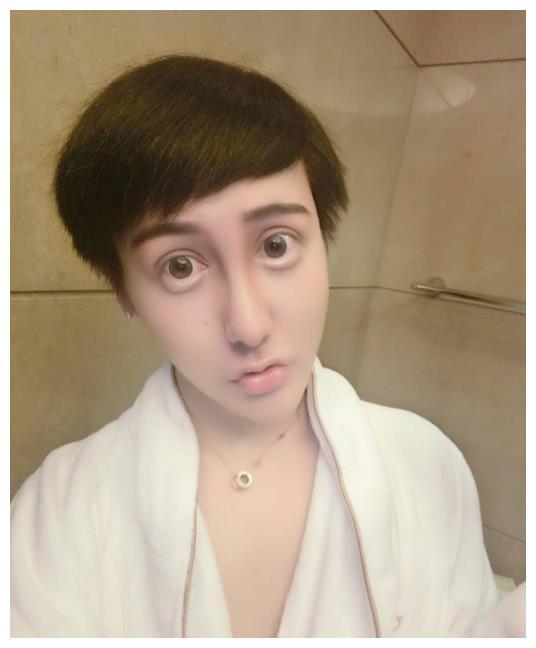 蛇精男刘梓晨2年后现身尖下巴和大眼睛没了混成油腻大叔