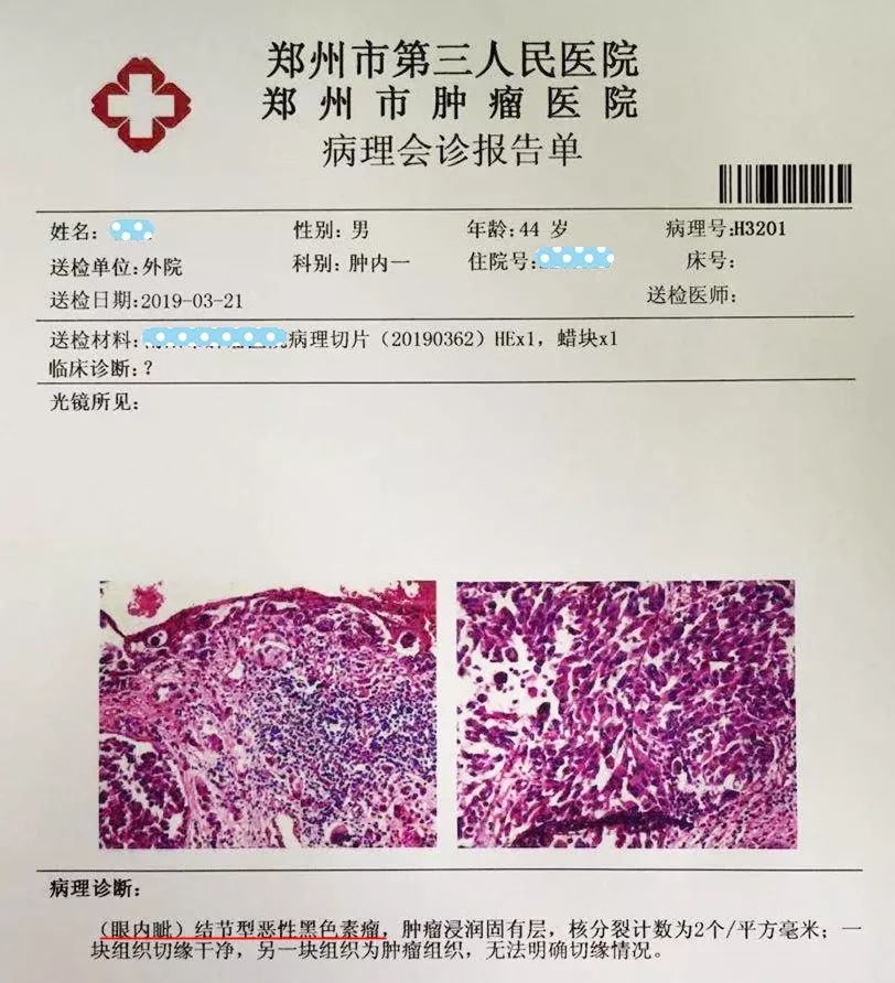 关注前沿针尖大的眼中钉实则危险的黑色素瘤