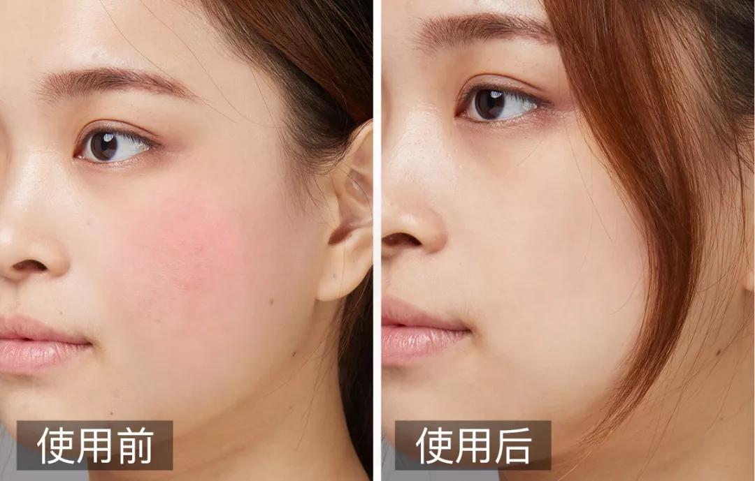 又一新升级!一抹饱满弹嫩,28天焕现紧致新肌!