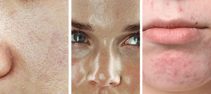 用它拯救你的岁月摧残肌_肌肤