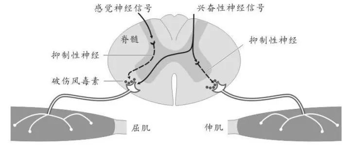 婴儿颈项强直图片图片