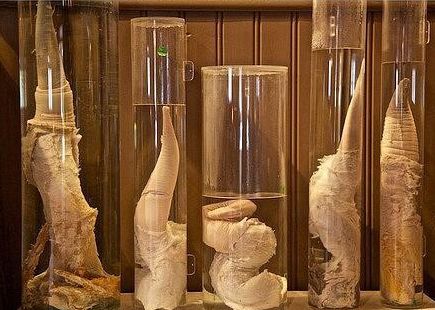 世界上首个阴道博物馆即将开业绝对不污