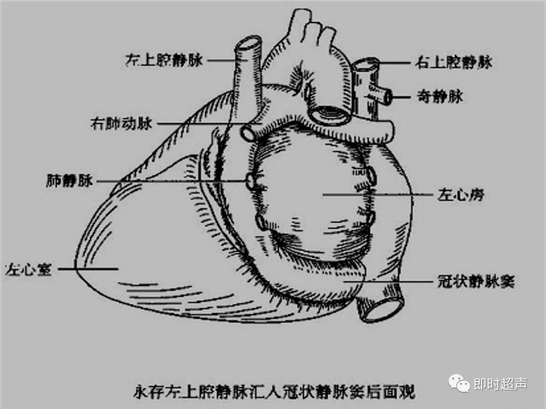 心脏界沟图片