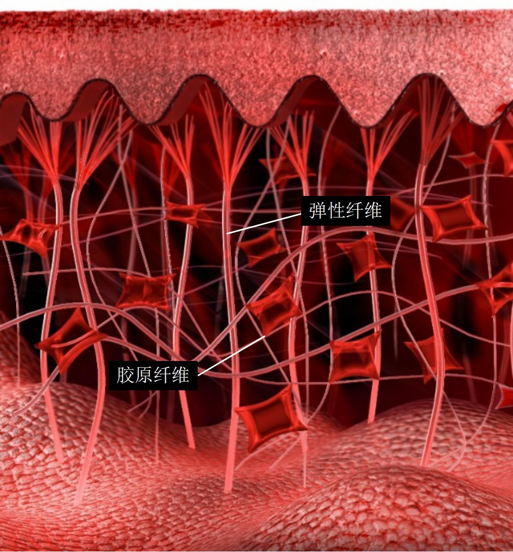 皮肤内弹性纤维断裂图图片