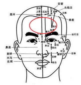 3,前额疼(额头),属阳明经2,两侧疼又叫偏头疼(包括,太阳穴附近,及后脑