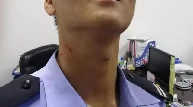 打伤警察毁坏设备!结果.