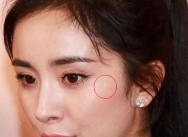 当红明星脸上也有疤痕,高清镜头下即刻暴露,胡歌最让人心疼