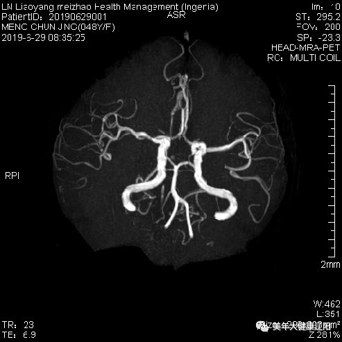头颅MRA解剖图片