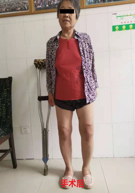 临西县医院最破的女人图片