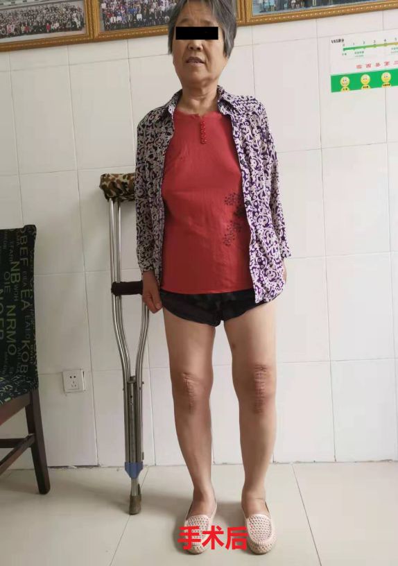 临西县第三人民医院秉承以服务人民为宗旨,以解除患者病痛为己任,切