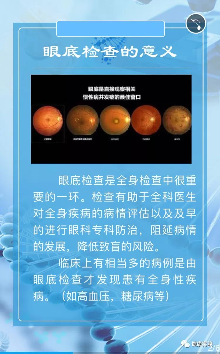 好消息慢性病眼底病变筛查免费做啦快点看过来