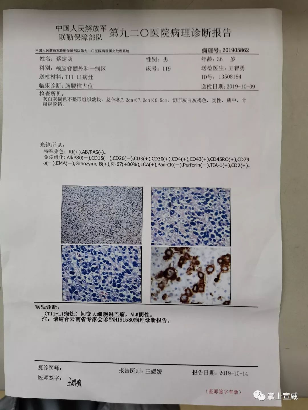 挽救宣威这家人男子淋巴癌扩散母亲肺癌待治