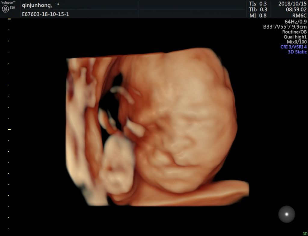 怀孕27周胎儿多大图片