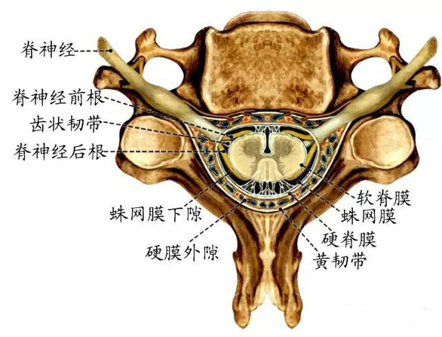 腰椎蛛网膜图片
