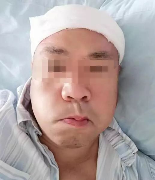 某大型医院因面肌痉挛做手术,术后发生面瘫,面颊萎缩下垂,嘴歪眼斜