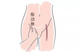 股浅动脉位置图片图片