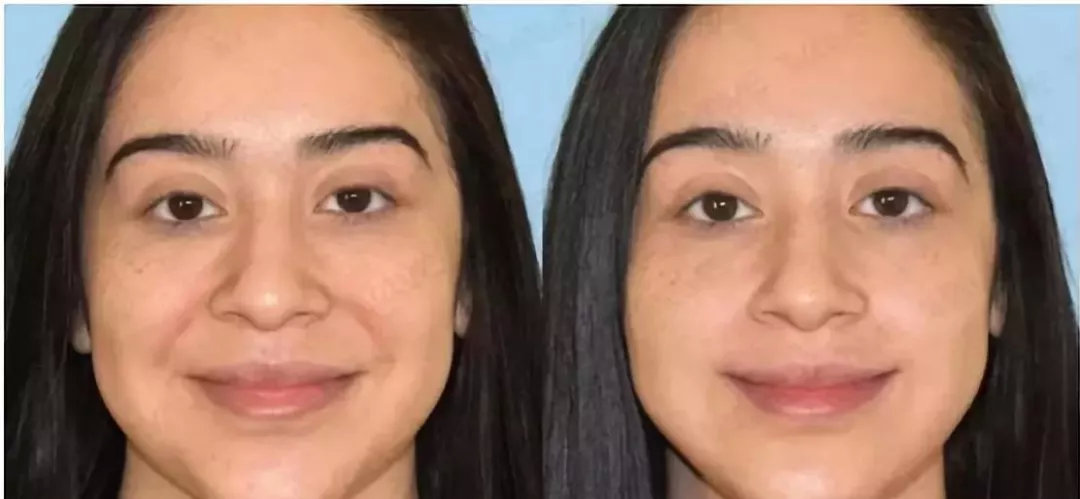 如何拯救你的这张「熬夜早衰脸」_皮肤