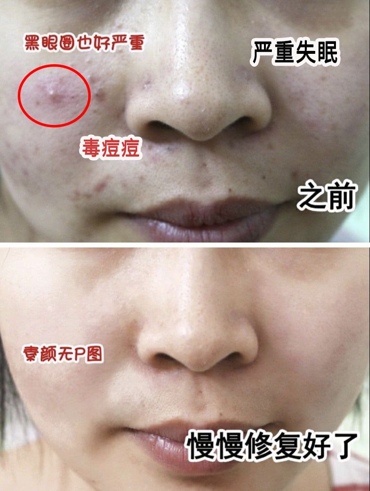 严重失眠睡前枕边喷一喷脸色好不脱发小肚子都没了