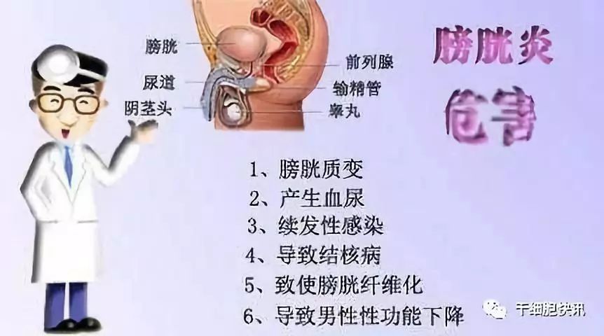 幹細胞療法幹細胞與治療泌尿系統疾病和保護生殖系統的作用