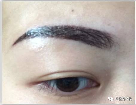 雾眉结痂过程,雾眉结痂蜕变高清图片