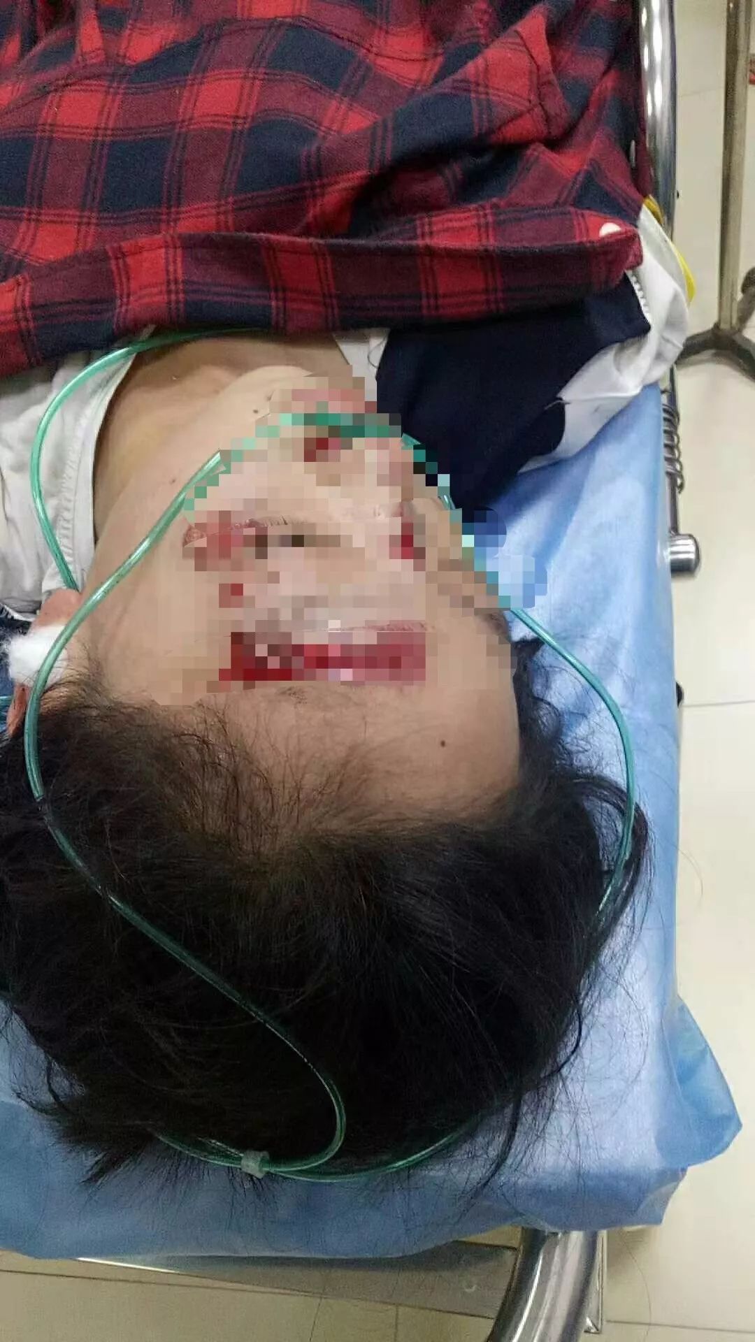 痛心梅州发生两起车祸一学生被压大货车底一老人腿被碾断