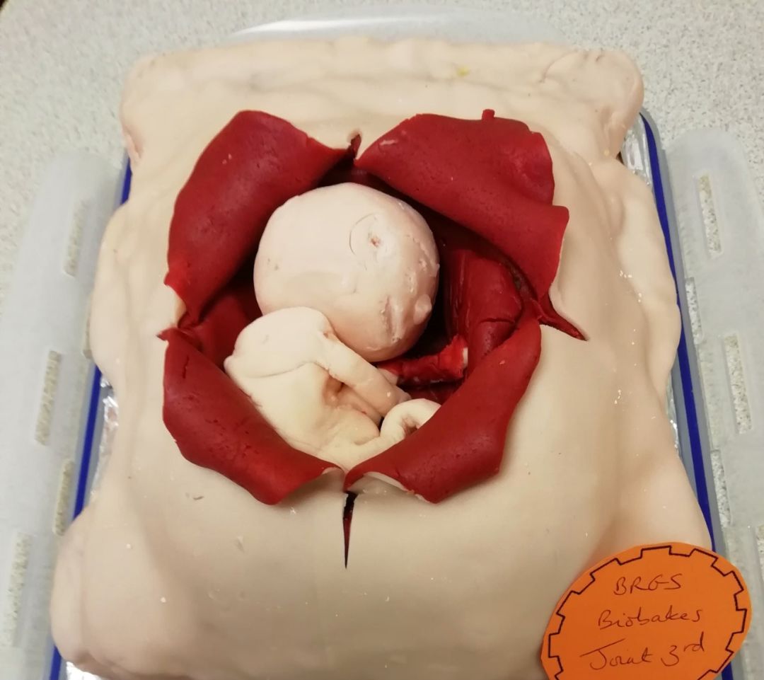 乳房蛋糕分泌些啥迪丽热巴被老牛吃嫩草安踏勾搭孙悟空设计烩报239期