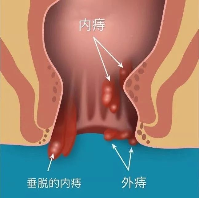 现代人什么都行,就是屁股不行