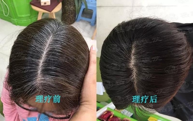 岳灵生发百科专业问答洗发水无硅油就一定健康吗