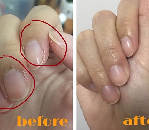 日本变态手霜效果堪比换皮轻轻一抹双手一夜重回婴儿肌