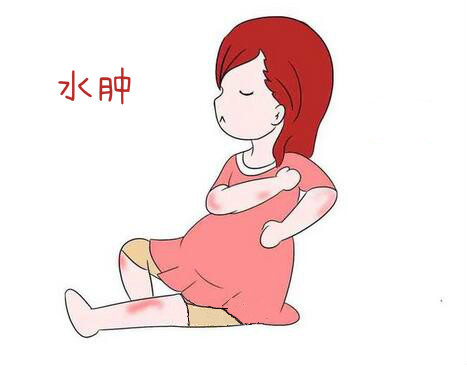 孕妇准妈妈们注意啦妊娠水肿原因要分清预防方法要记牢