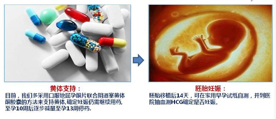 做試管嬰兒需要注意什麼?