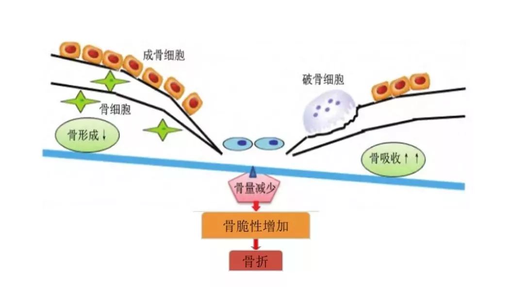 年轻的时候,成骨细胞占主导,随年龄增长,破骨细胞增殖.