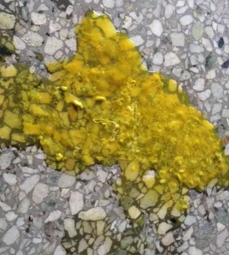 专对2 岁内孩子下手,严重可致死,秋冬最常见的传染病又来了