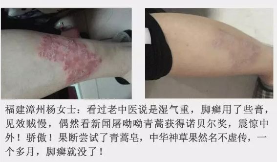 路边有一种野草煮水一洗10痒9消连皮炎湿疹都好了