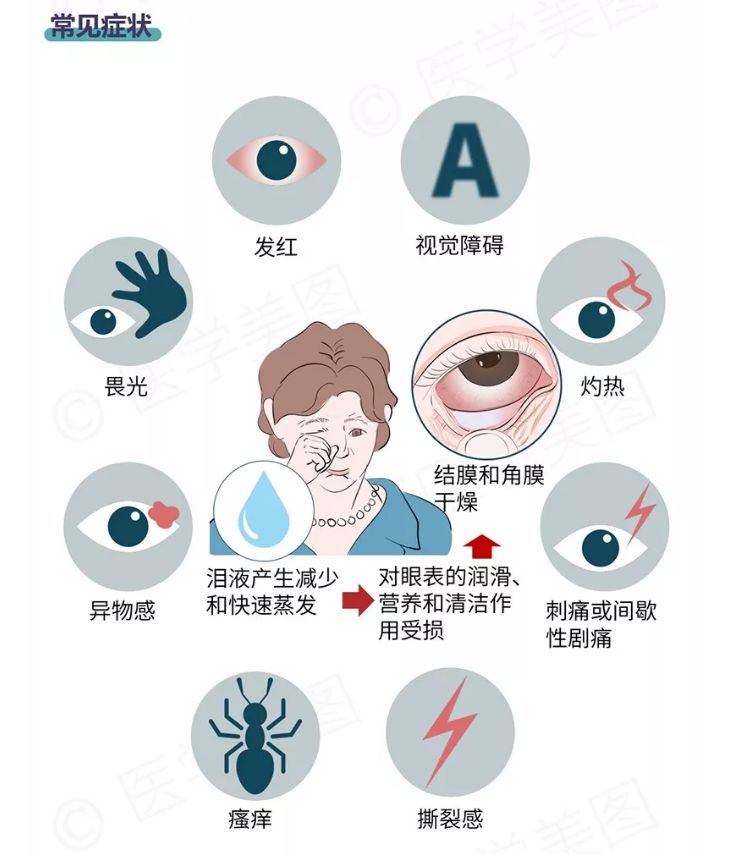 眼病种类图片