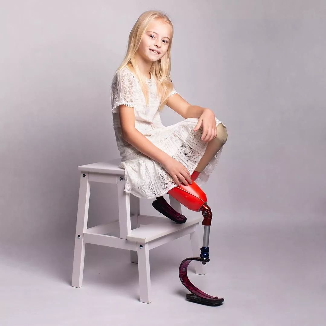 残疾女孩无腿图片